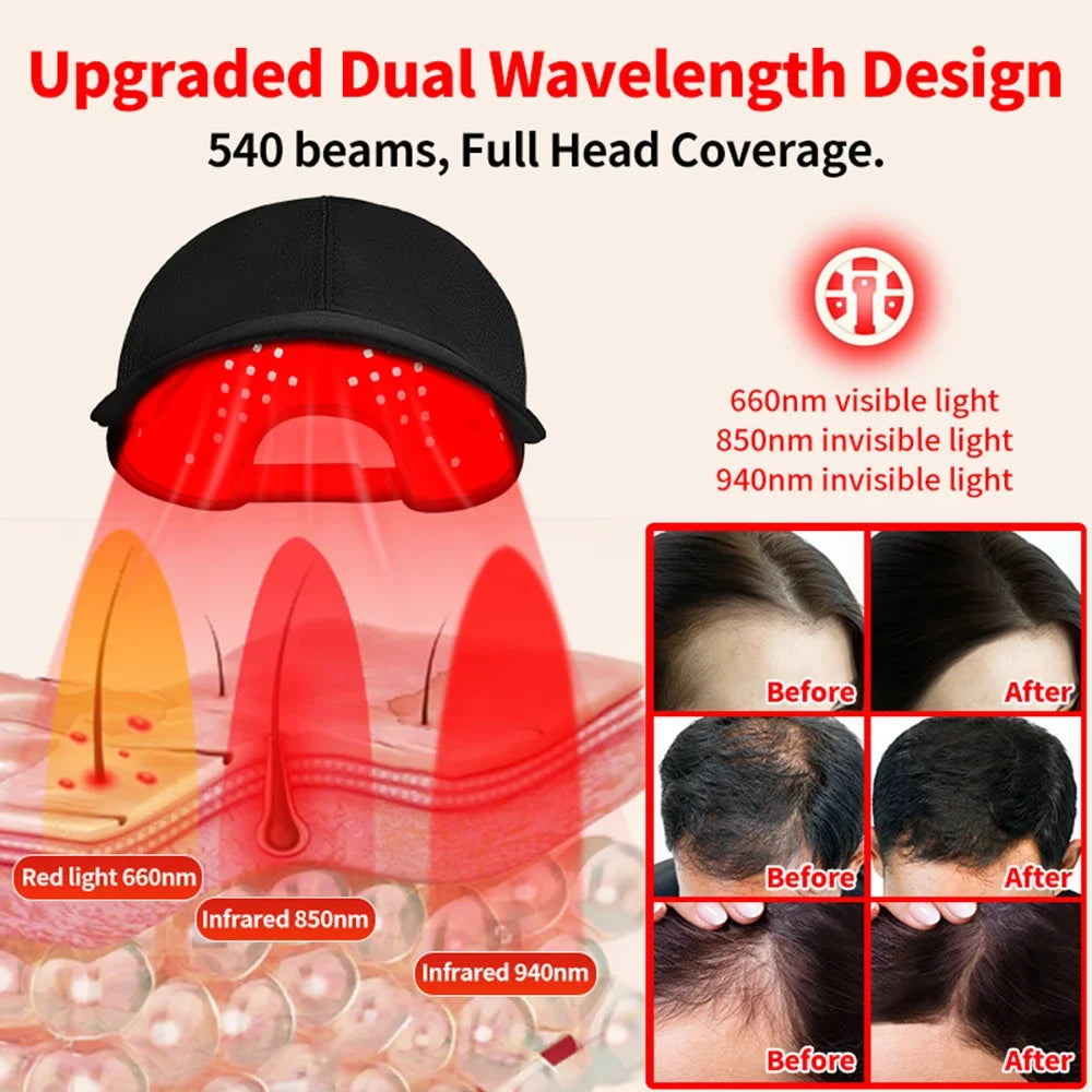 Red Light Therapy Hair Growth Cap